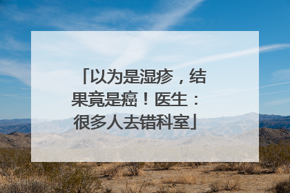 以为是湿疹，结果竟是癌！医生：很多人去错科室