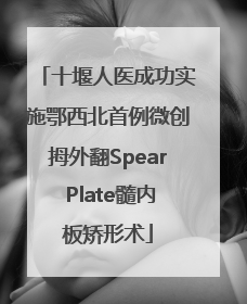 十堰人医成功实施鄂西北首例微创拇外翻Spear Plate髓内板矫形术